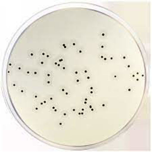 Agar Baird-Parker ISO, x30 Discos. Condalab