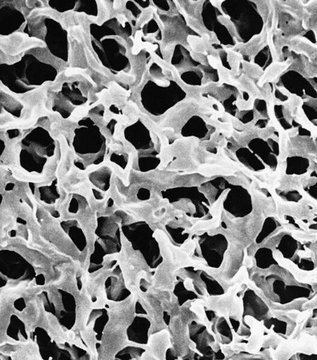 Filtro, MF-Millipore™, membrana de ésteres de celulosa , 0,45 µm x 47 mm, hidrófila