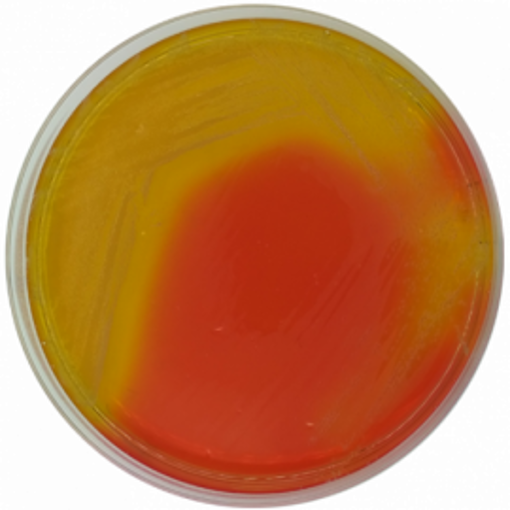 Base de Agar Selectivo Burkholderia Cepacia USP. 550 gr. Condalab